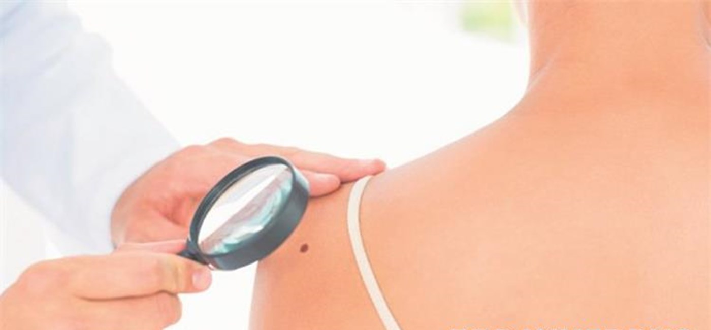 Beroš: Nastavljamo javnozdravstvenu akciju ranog otkrivanja melanoma na  hrvatskim otocima